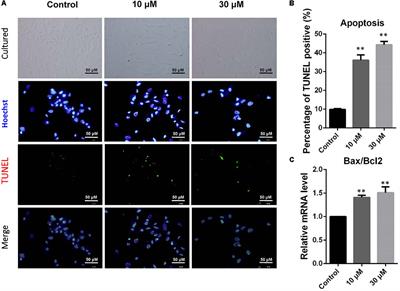 Zearalenone Exposure Enhanced the Expression of Tumorigenesis Genes in Donkey Granulosa Cells via the PTEN/PI3K/AKT Signaling Pathway